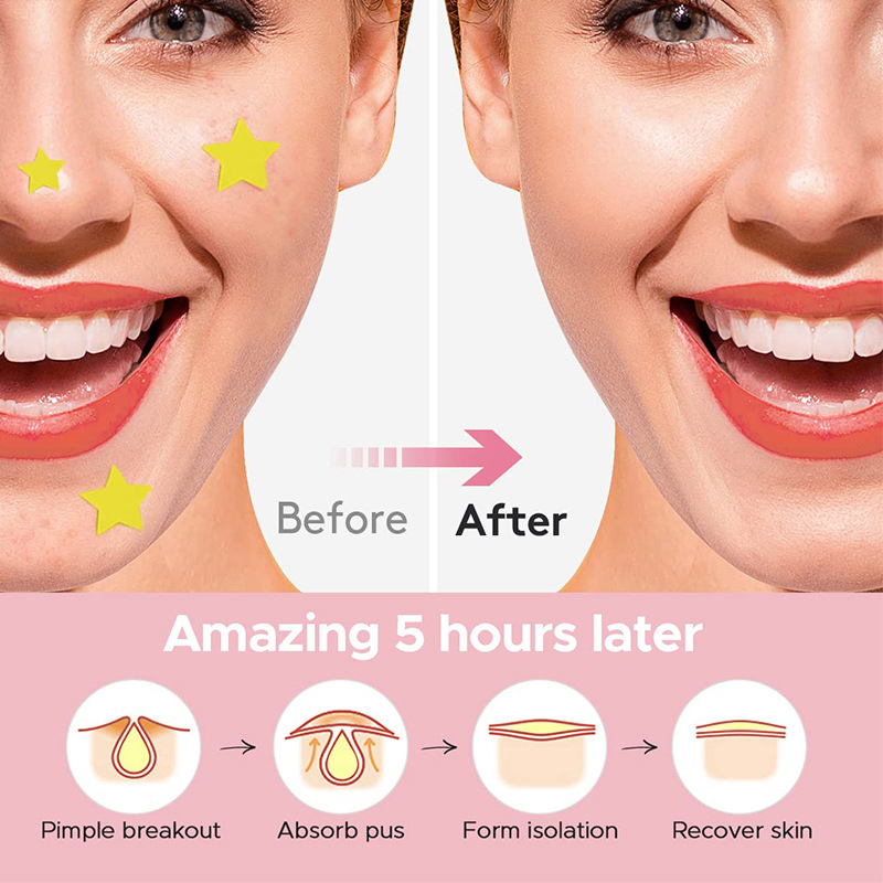 600 Teile/satz Stern Pickel Pa – Beauty Makeup Face Bewertung und Preis